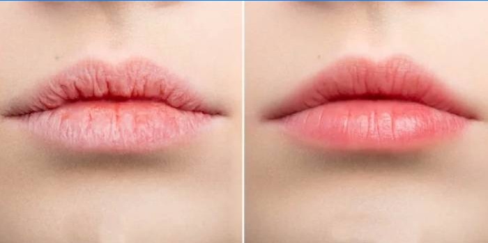 Labios antes y después de aplicar el bálsamo